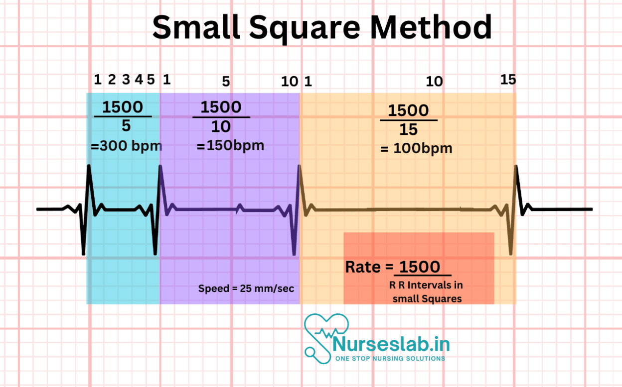 Rate R Mpa Calculating Heart Rate on an ECG: Explained - Nurseslab