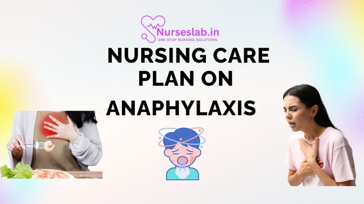 Nursing Care Plan on Anaphylaxis
