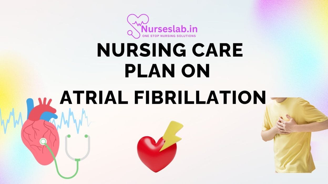 Nursing Care Plan on Atrial Fibrillation