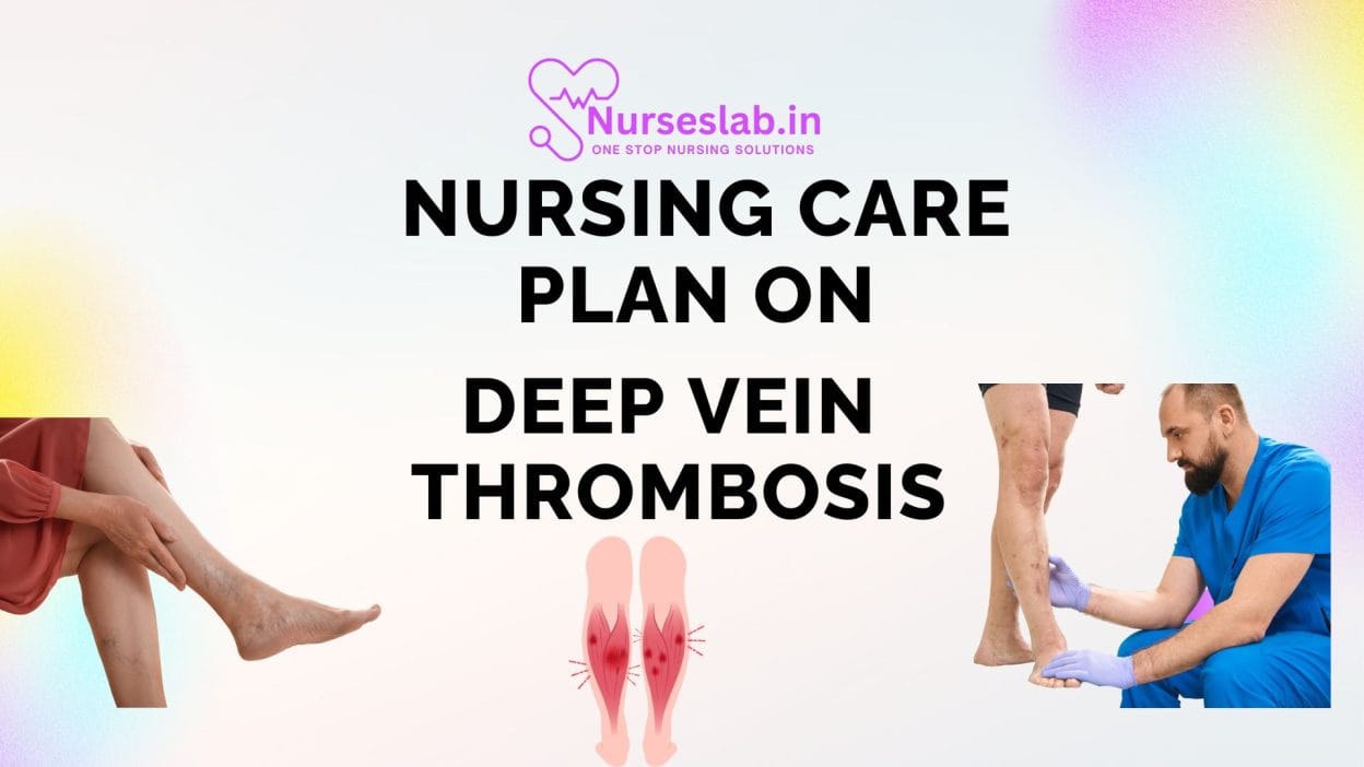 Nursing Care Plan on Deep vein Thrombosis