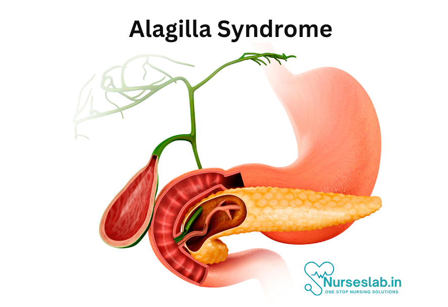 Alagille Syndrome: An Overview