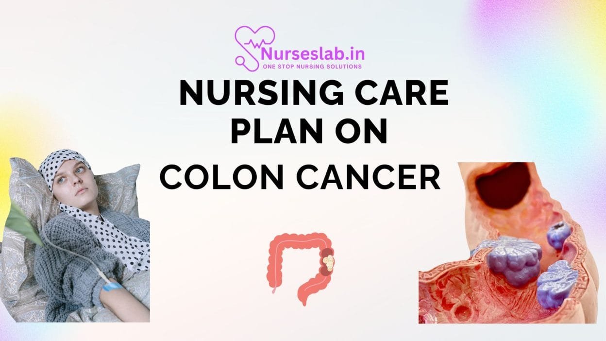 Nursing Care Plan on Colon Cancer
