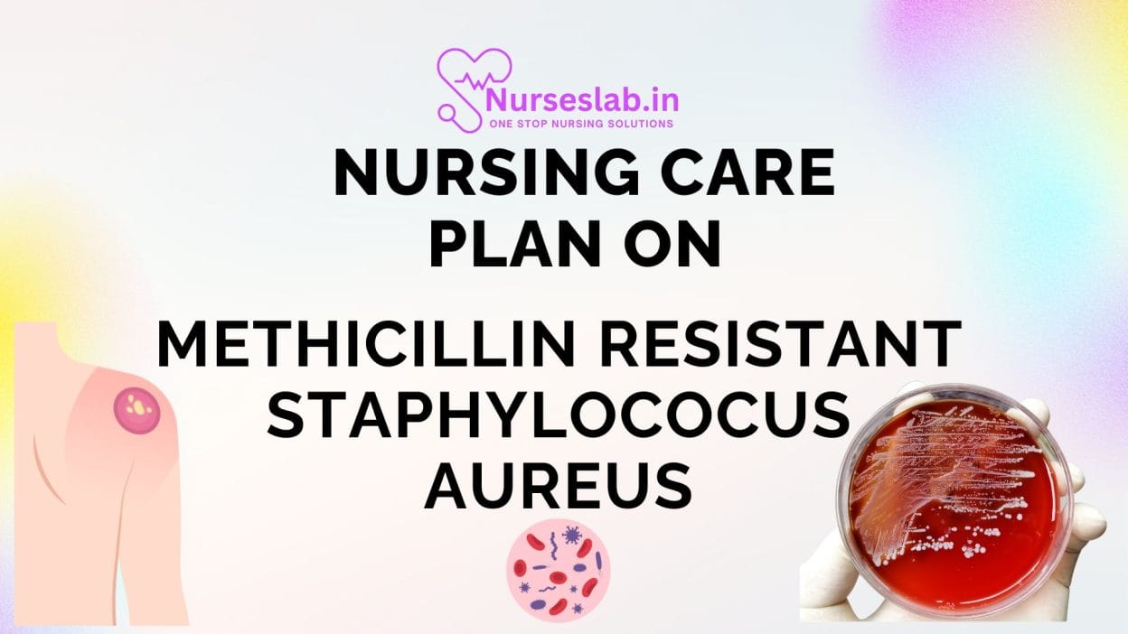 Nursing Care Plan on Methicillin Resistant Staphylococus Aureus