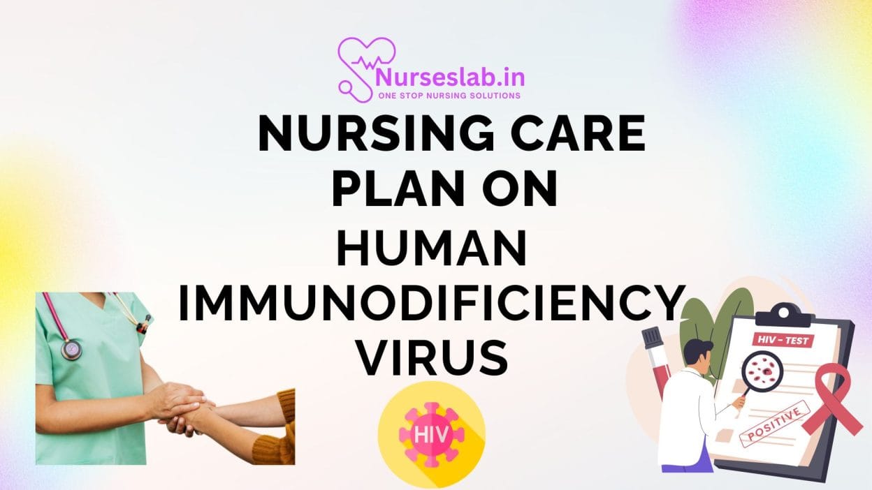 Nursing care Plan on HIV