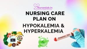 Nursing Care Plan on Hyperkalaemia and Hypokalaemia - Nurseslab