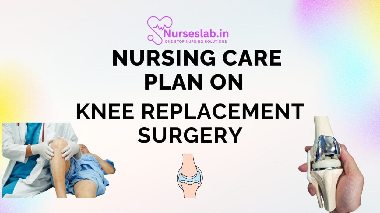 Nursing care Plan on Knee Replacemnt Surgery