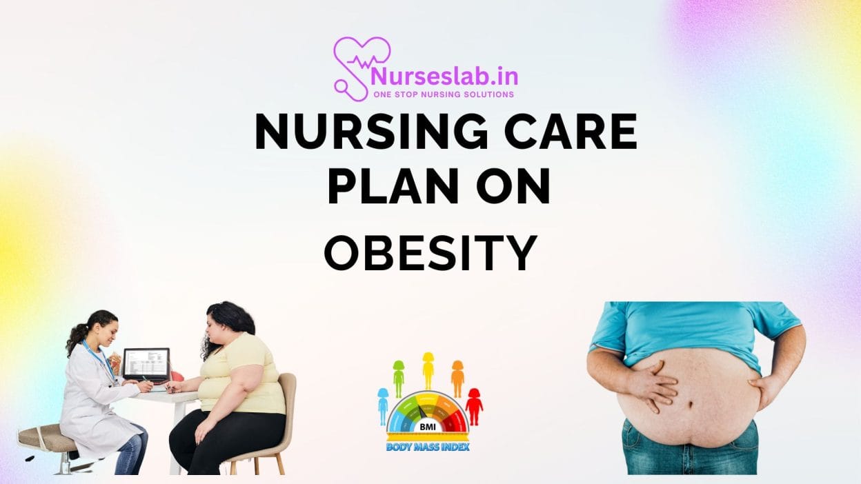Nursing care Plan on Obesity