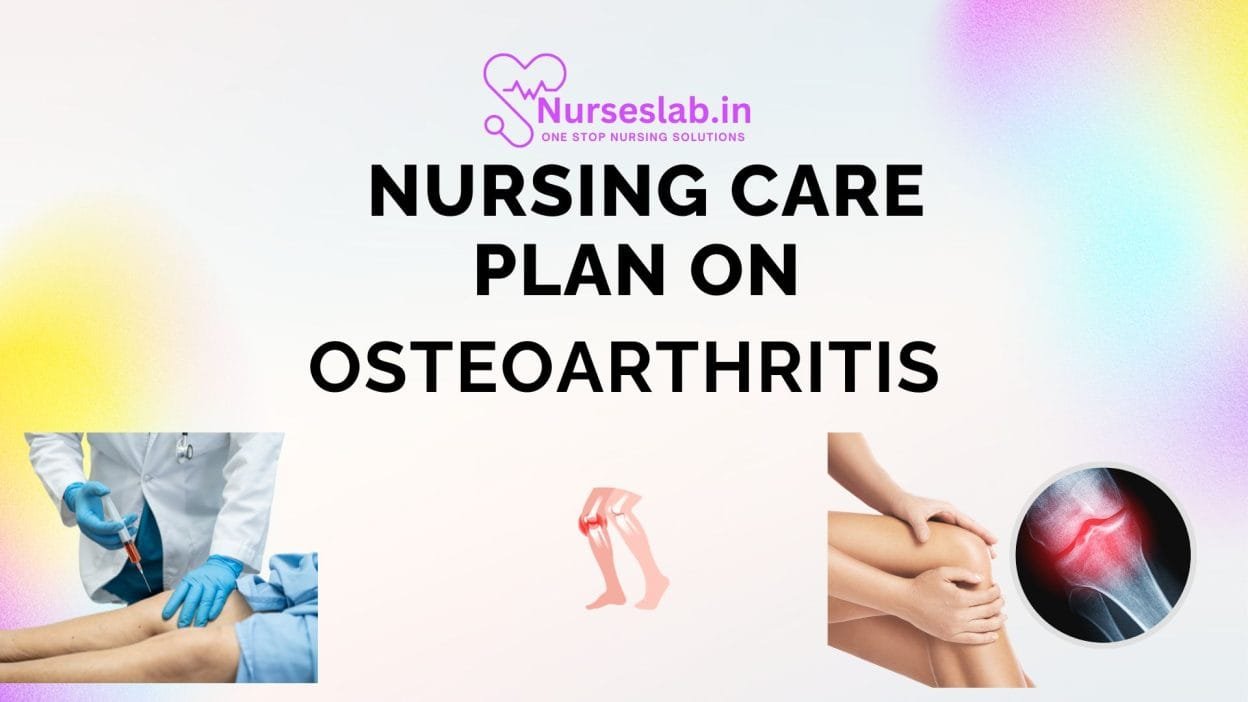 Nursing care Plan on Osteoarthritis