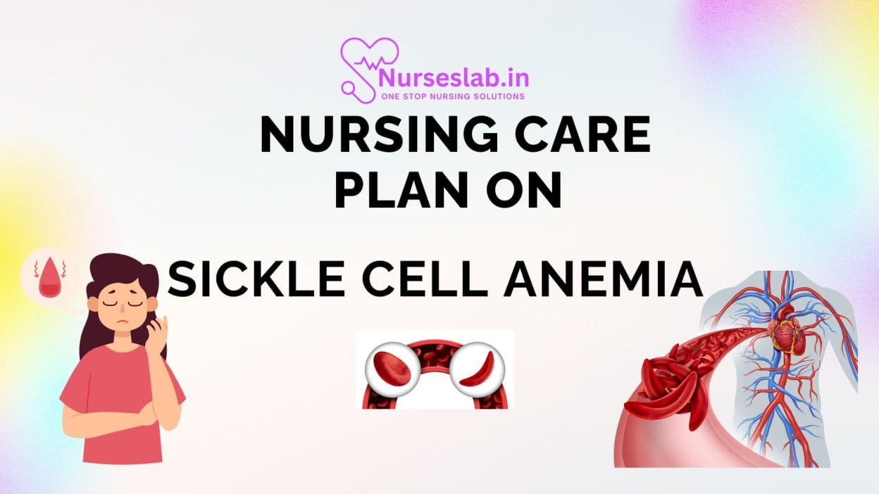 Nursing care Plan on Sickle Cell Anemia