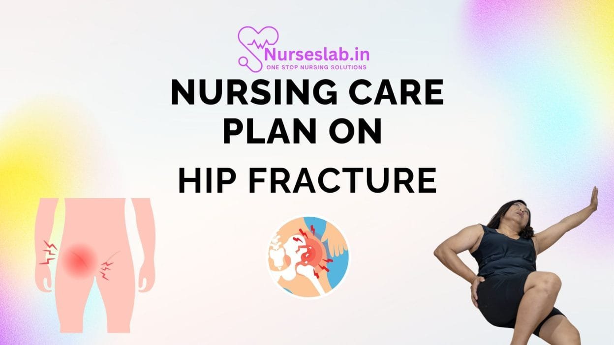 Nursing care Plan on Hip fracture
