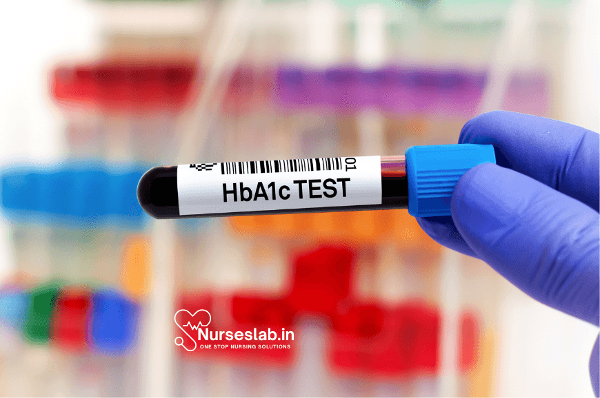 HbA1C and Its Important
