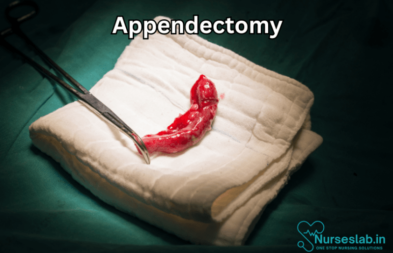 Appendectomy Surgery - Nurseslab