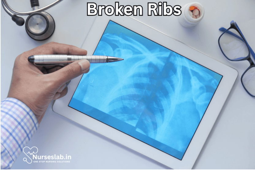 First Aid for Broken Ribs - Nurseslab