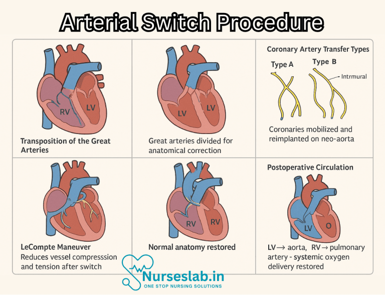 Arterial Switch Procedure - Nurseslab
