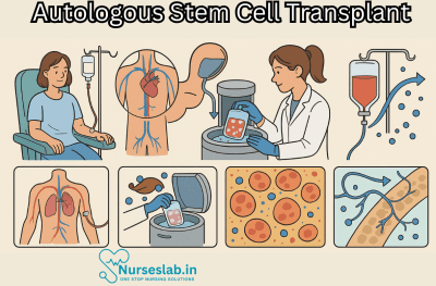 Autologous Stem Cell Transplant procedure - Nurseslab