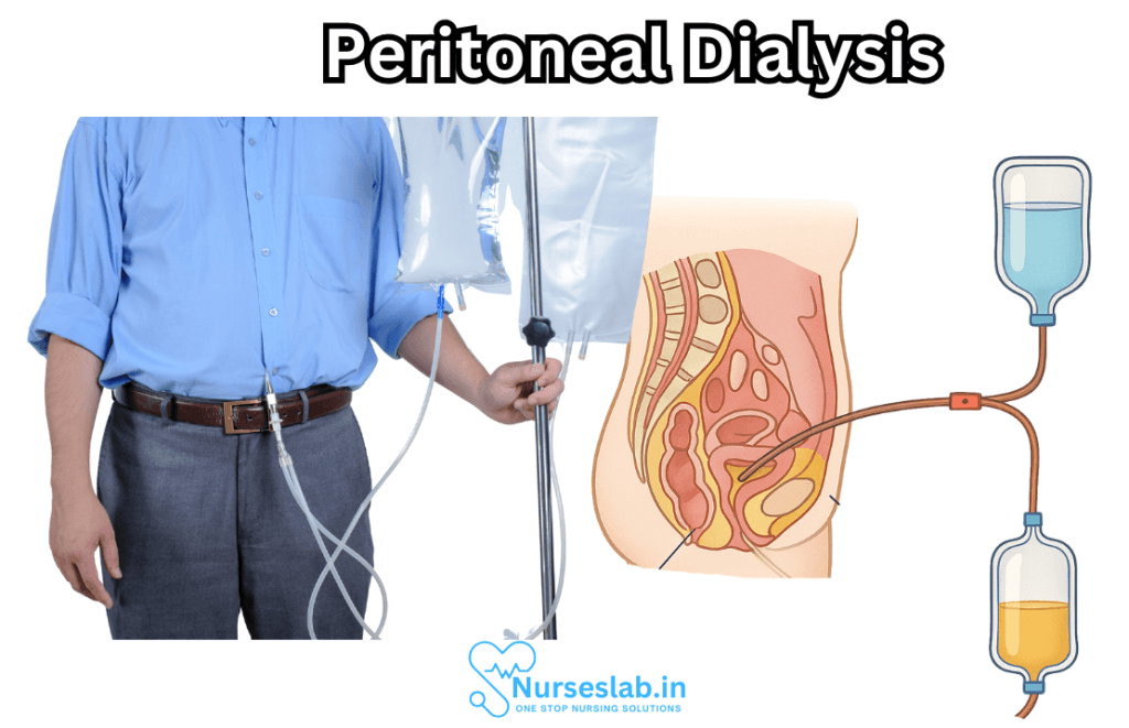Peritoneal Dialysis