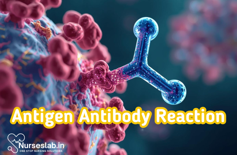 Antigen-Antibody Reactions - Nurseslab
