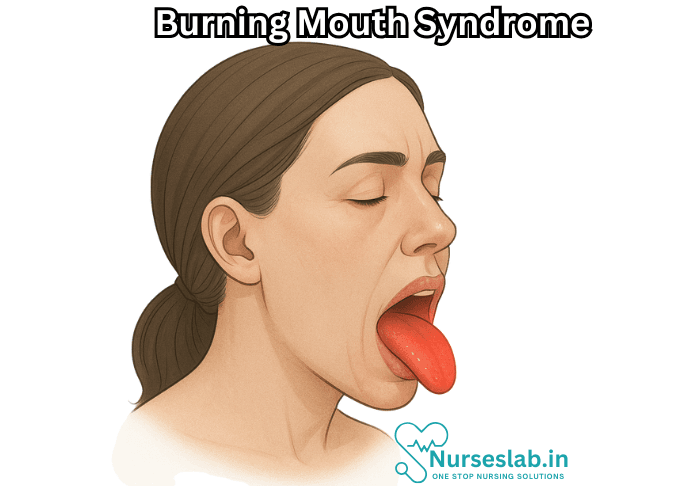 Burning Mouth Syndrome