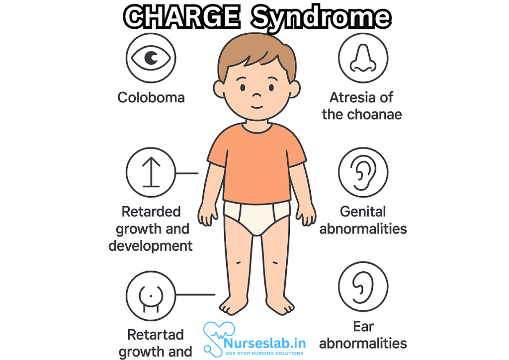 CHARGE Syndrome