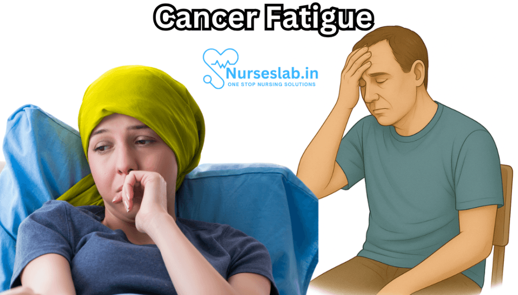 Cancer Fatigue