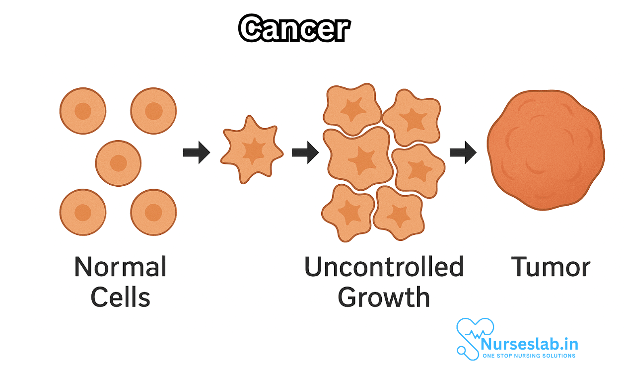 Cancer and 7 Types: A Comprehensive Overview - Nurseslab
