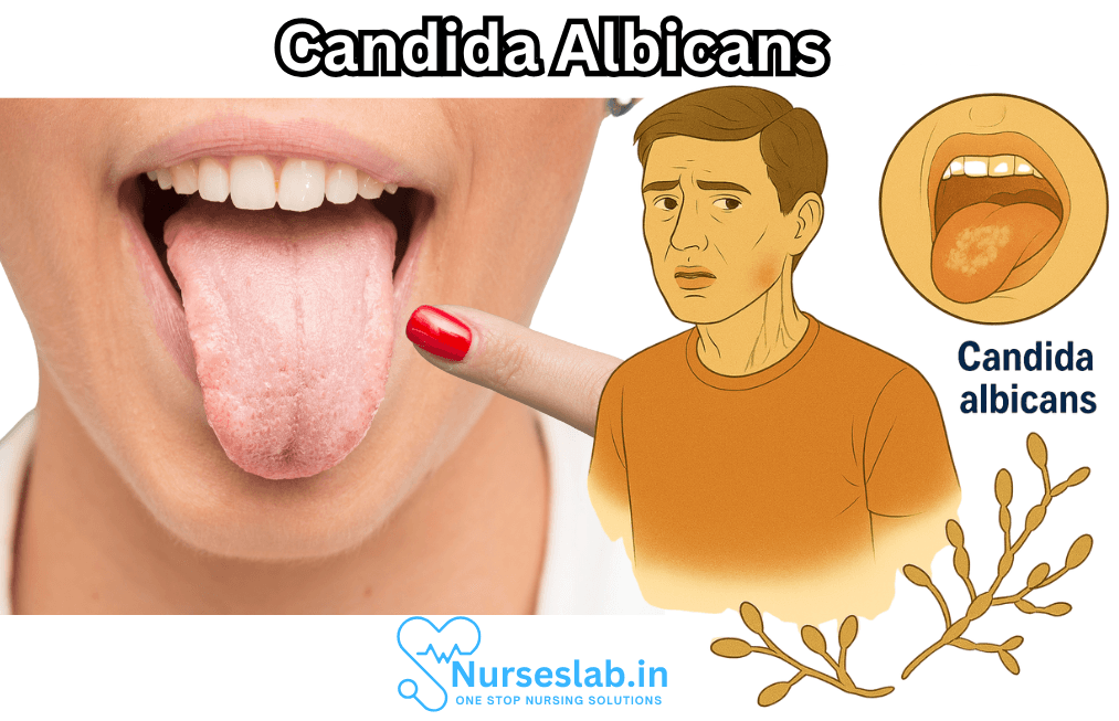 Candida Albicans