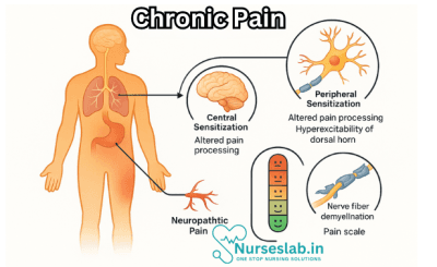 Chronic Pain: A Comprehensive Exploration - Nurseslab