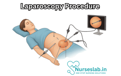Lspsroscopy Laparoscopy procedure: A Comprehensive Overview - Nurseslab