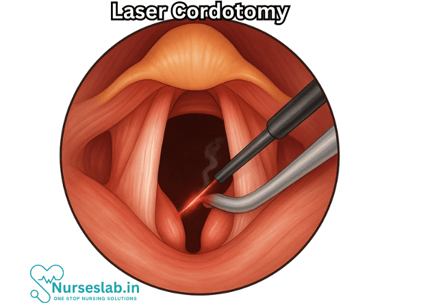 Laser Cordotomy