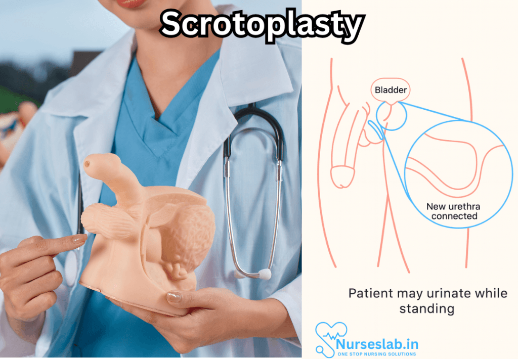 Scrotoplasty
