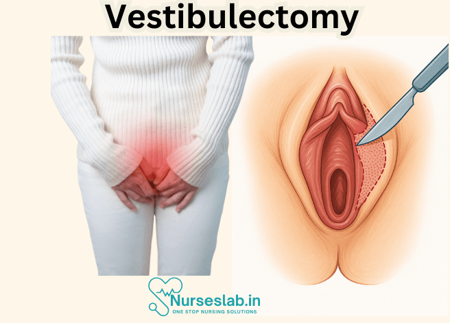 Vestibulectomy