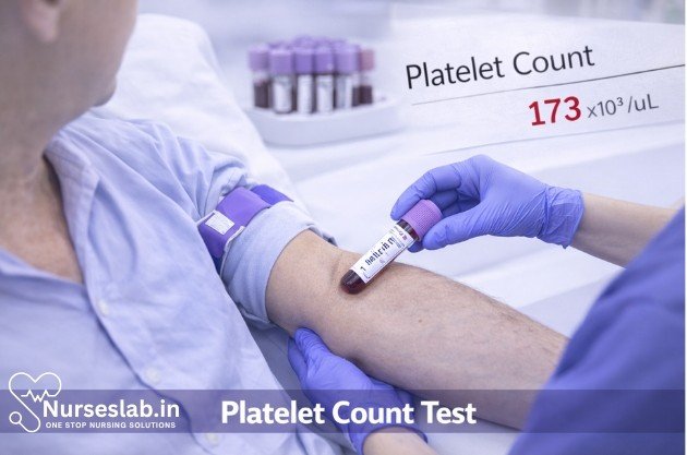 platelet count