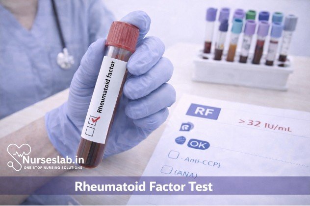 Rheumatoid Factor