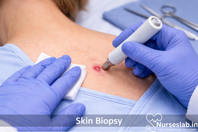 Skin Biopsy