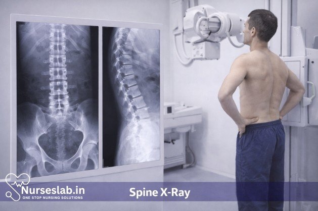 Spine X-Ray