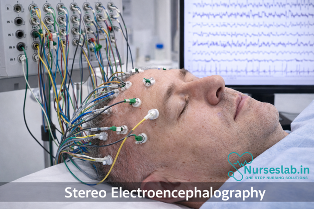 Stereo electroencephalography