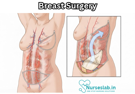 Breast surgery